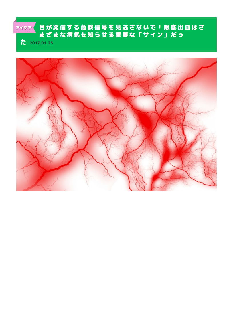 目が発信する危険信号を見逃さないで！眼底出血はさまざまな病気を知らせる重要な「サイン」だったのイメージ写真