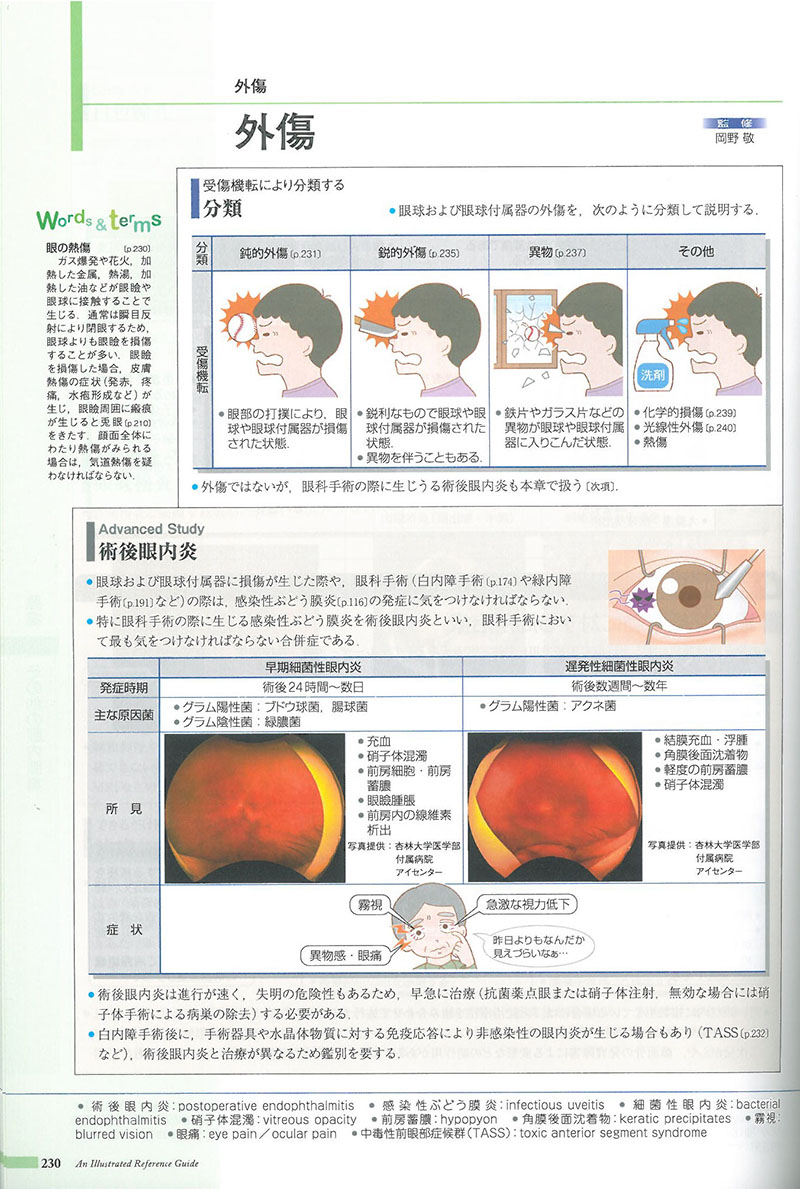 病気がみえるvol.12眼科のイメージ写真