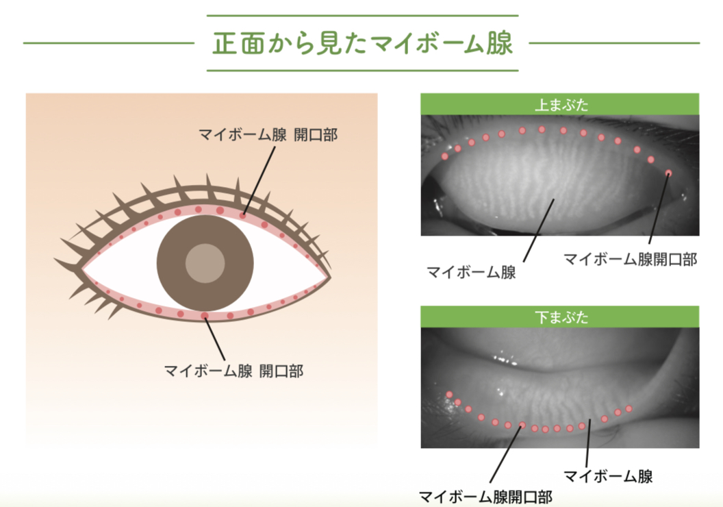 まぶたにあるマイボーム腺の位置を示したイラスト