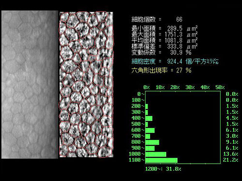 細胞が死滅し、１個の細胞が大型化している